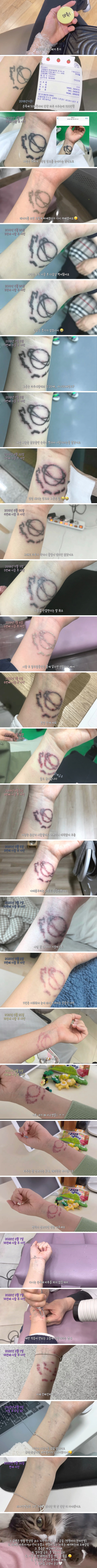 타투제거한 여성 후기 ㄷㄷ